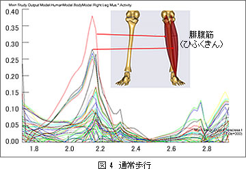 図4　通常歩行